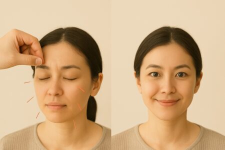 鍼灸でアンチエイジング｜“疲れ顔”から“冴える顔”へ
